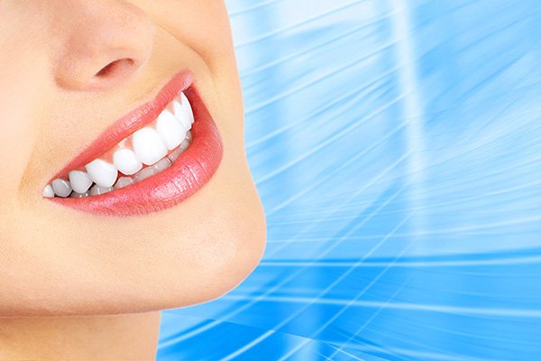 Why You Should Consider Getting Dental Veneers