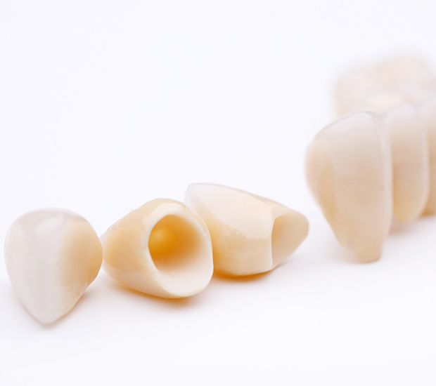 Atlantis Dental Crowns and Dental Bridges