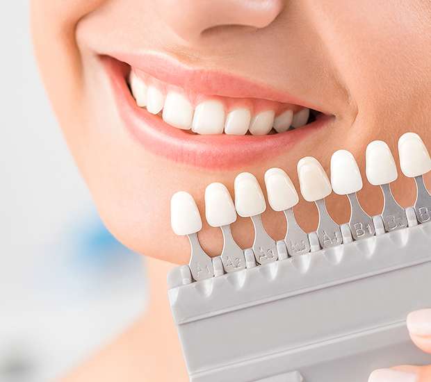 Atlantis Dental Veneers and Dental Laminates