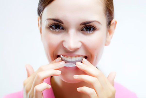 Does Invisalign Have To Be Worn At All Times?