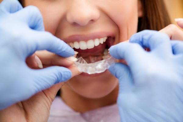 Orthodontics: How Invisalign® Straightens Teeth